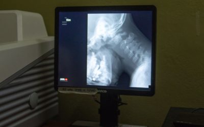 Digitalizador de radiografías para Castilla